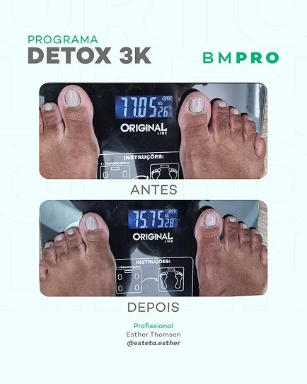Antes e depois — emagrecimento e detox por profissional habilitada