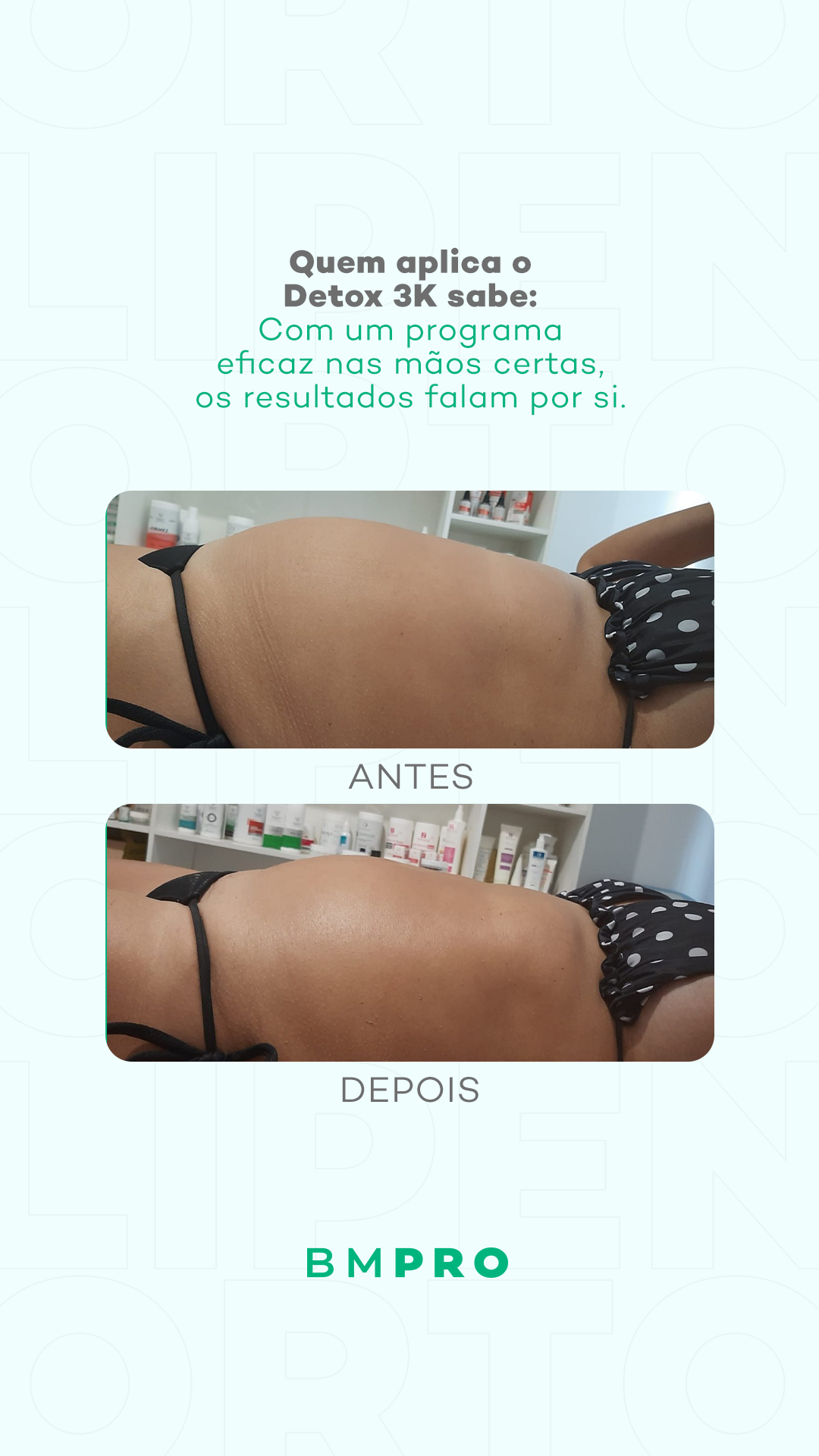 Antes e depois — detox e emagrecimento por profissional habilitada
