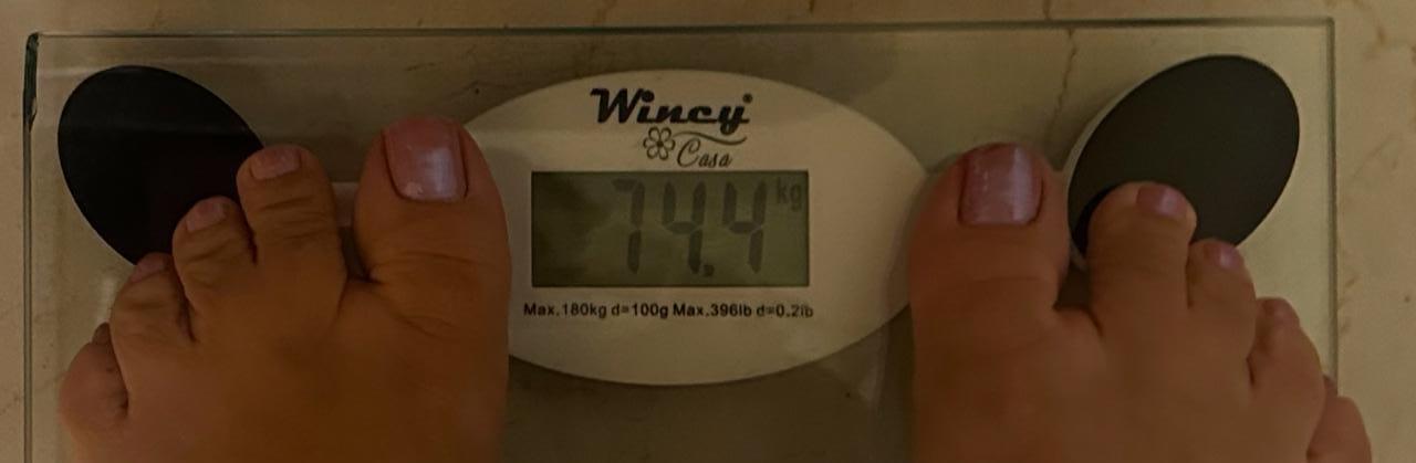 Antes e depois — detox e emagrecimento por profissional habilitada