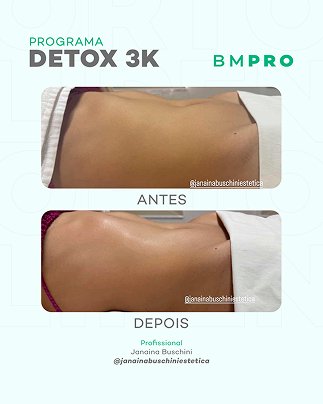 Antes e depois — emagrecimento e detox por profissional habilitada
